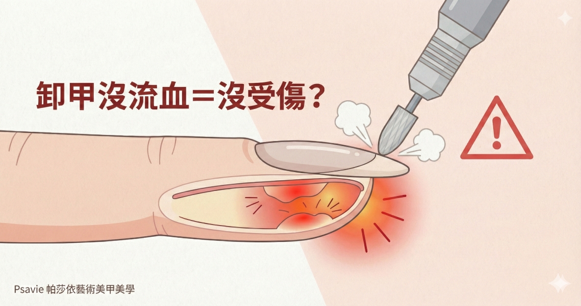 卸甲沒流血就代表沒受傷？揭開「一層殘」與凝膠卸除的迷失